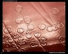 Streptococcus pneumoniae